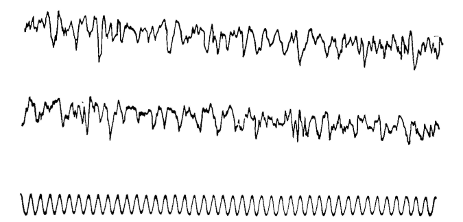 wave form of street noise